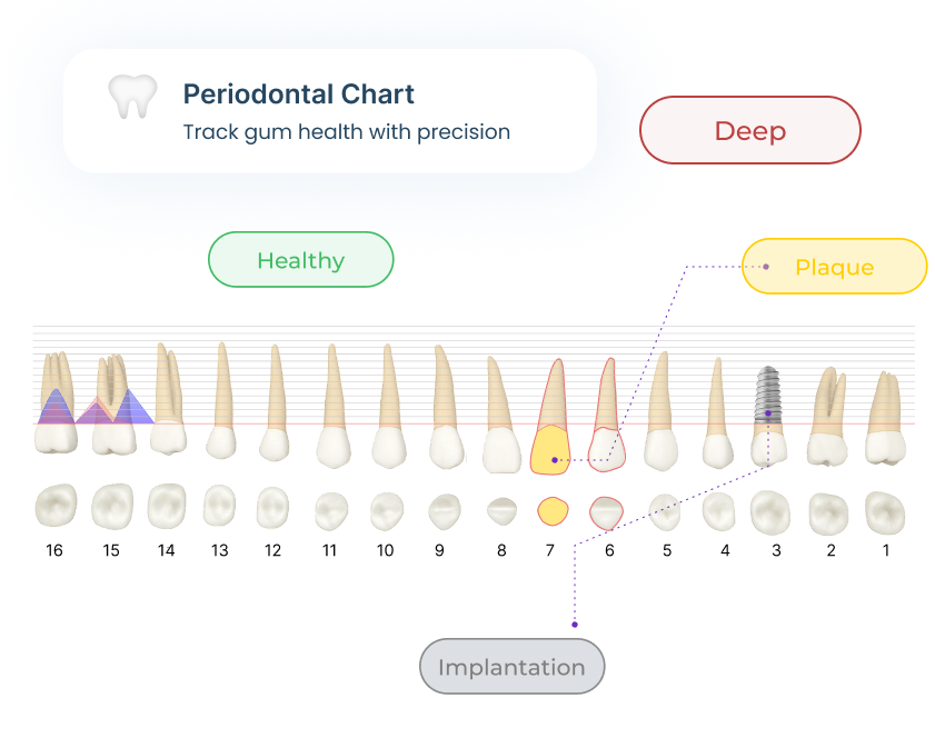 AI periodontal charting tool for dentists
